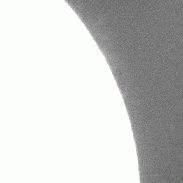 <font class="tempImageTitleThumbText">393.37 Calcium Prominences</font><br>Apollo P Lasky<br>Sep 13 9:36pm<br>Naperville, Illinois
