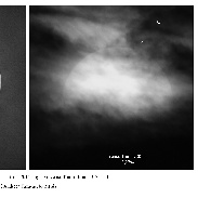 <font class="tempImageTitleThumbText">Mercury Transit</font><br>Fazacas Andreea<br>May 9 9:02pm<br>Virteju, Ilfov