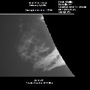 <font class="tempImageTitleThumbText">The Solar Prominence...</font><br>Frank J Melillo<br>Feb 7 3:50am<br>Holtsville, NY