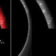 <font class="tempImageTitleThumbText">Solar Prominences</font><br>James Roger Samworth<br>Sep 8 10:55am<br>Nailstone, Nuneaton, UK